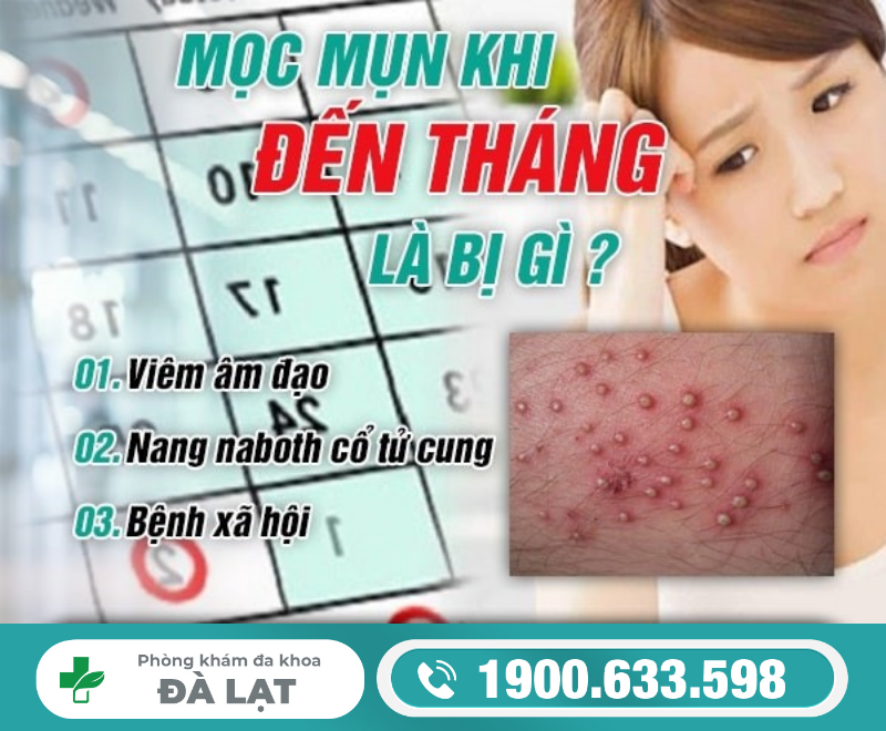 Hình ảnh minh họa